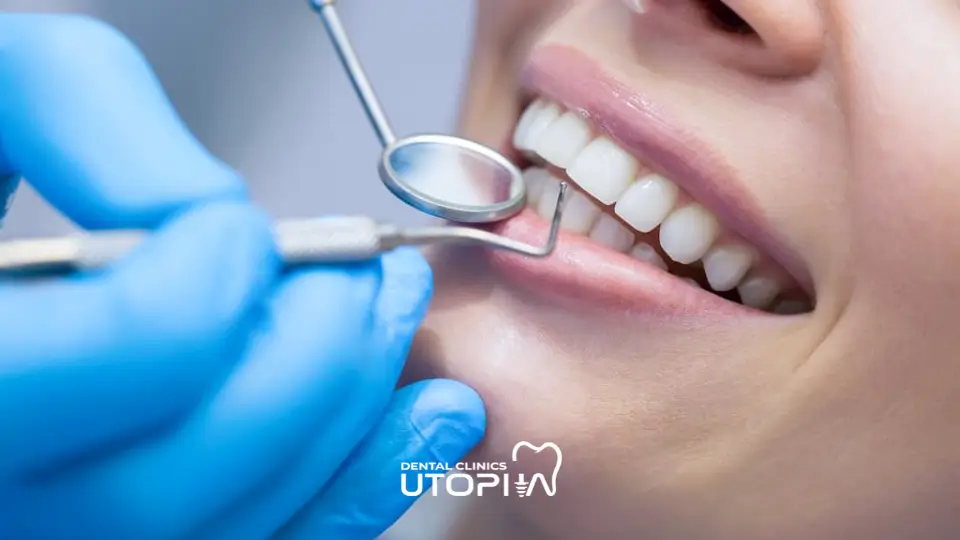 What To Do After a Dental Cleaning What To Do After a Dental Cleaning
