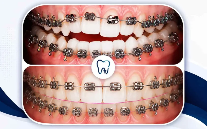 Orthodontics